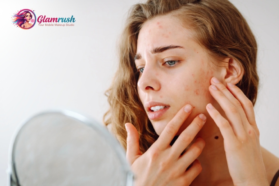 How New Yorks Pollution Affects Skin And How To Stop It 2 Pollution generates free radicals that destroy collagen and clog pores.