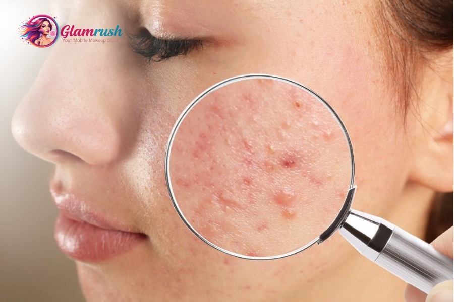 How New Yorks Pollution Affects Skin And How To Stop It 3 Pollution irritates skin, worsening eczema and psoriasis.