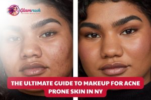 The Ultimate Guide To Makeup For Acne Prone Skin In NY