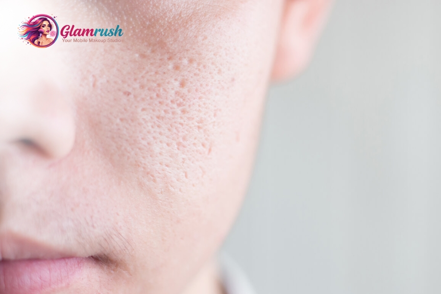 9 Expert Tips To Minimize The Appearance Of Large Pores 3 Genetics set pore size, but care makes improvements